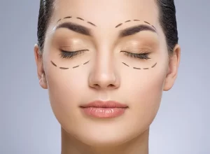 blefaroplastia