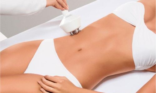 criofrequencia-bodyhealth