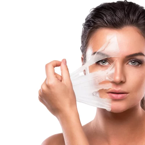 peeling-quimico